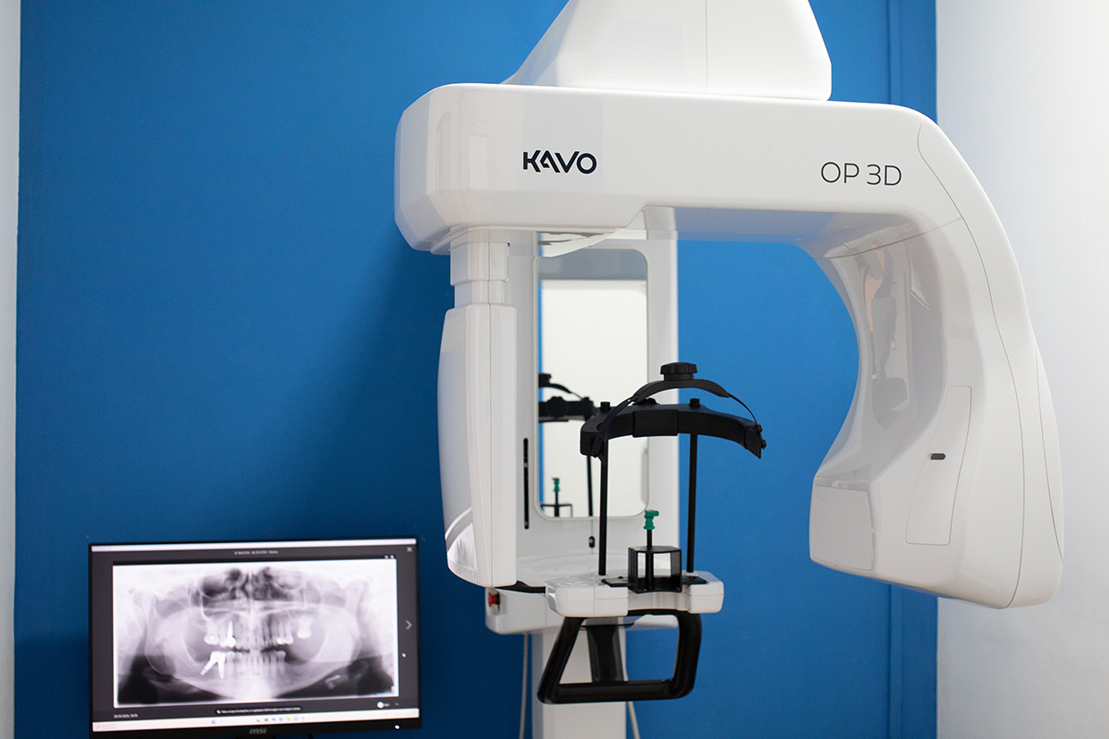 Endodonzia a Monterotondo RM